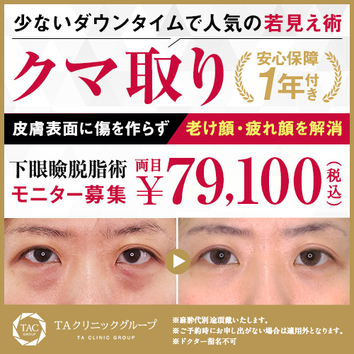 下眼瞼脱脂（目の下のクマ・ふくらみとり）モニター募集
